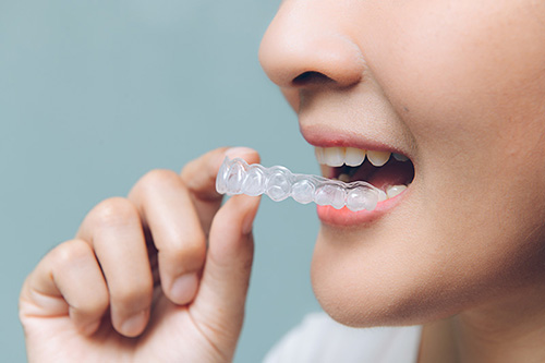1Smile Dental | Braces, Implant Dentistry and Botox®